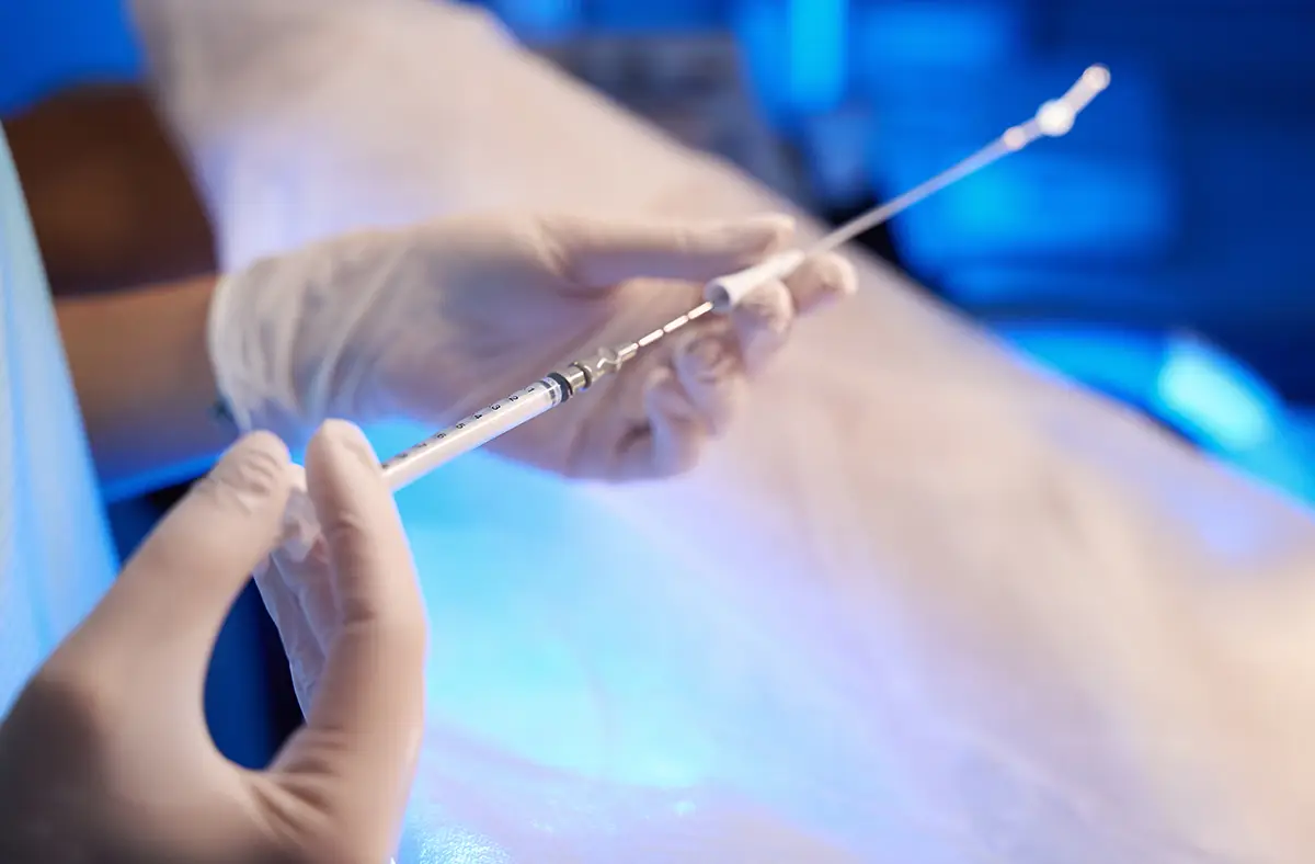 insémination intra-utérine - Dr Jade Raad