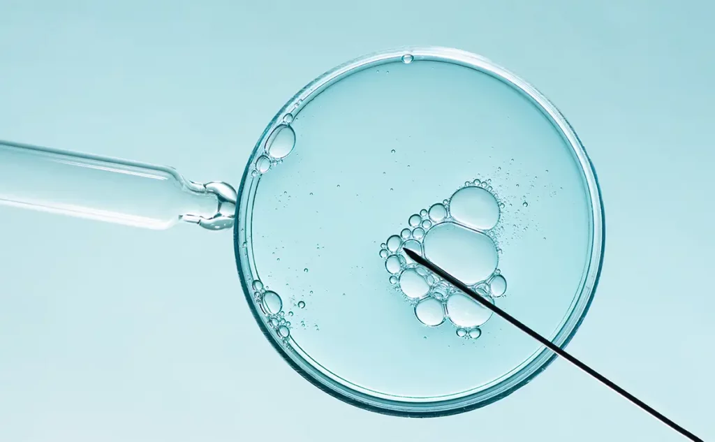 Échecs d’implantation après FIV : causes, bilan et solutions